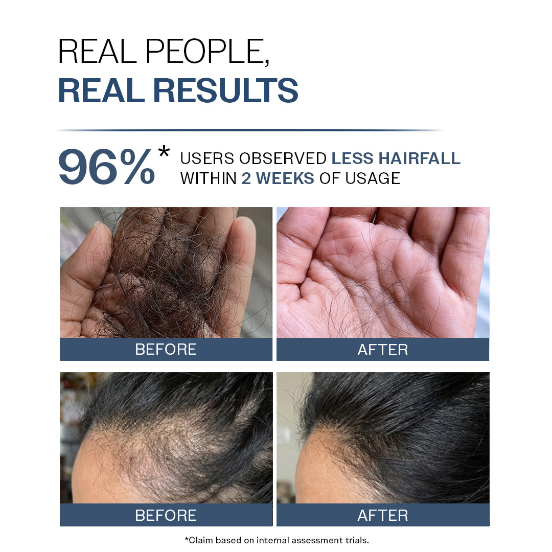 Anti-Hair Fall Shampoo with Adenosine & Peptides | 5X Hairfall Control - 250 ml
