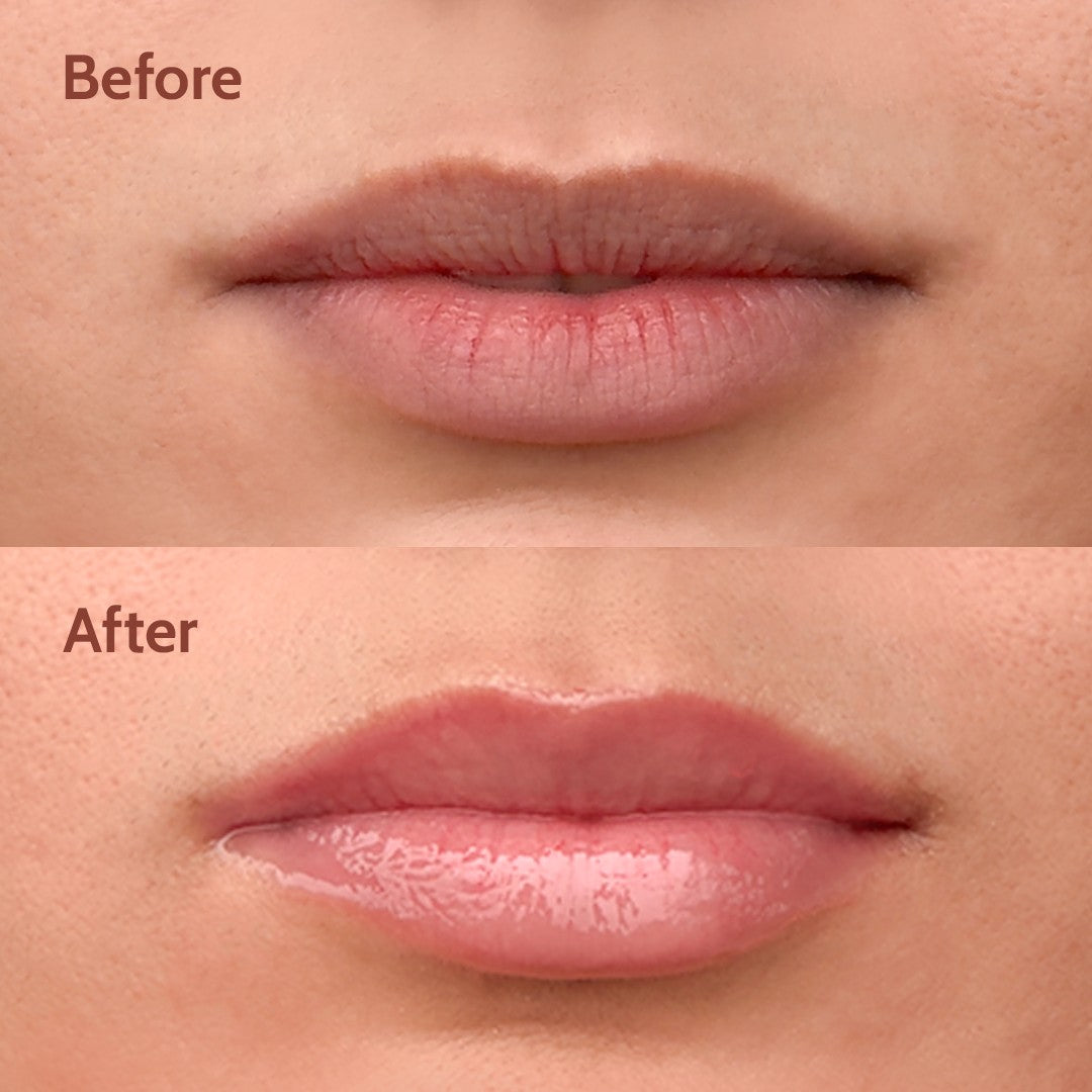 Ceramides + 2% Kojic Acid Lip Balm (Vanilla) | SPF 50 PA++++ | 10 gm