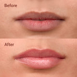 Ceramides + 2% Kojic Acid Lip Balm (Vanilla) | SPF 50 PA++++ | 10 gm