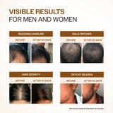 Advanced Hair Growth Serum with 3% Redensyl, 4% Anagain, 3% Bicapil & 1% Capilia Longa - 30 ml