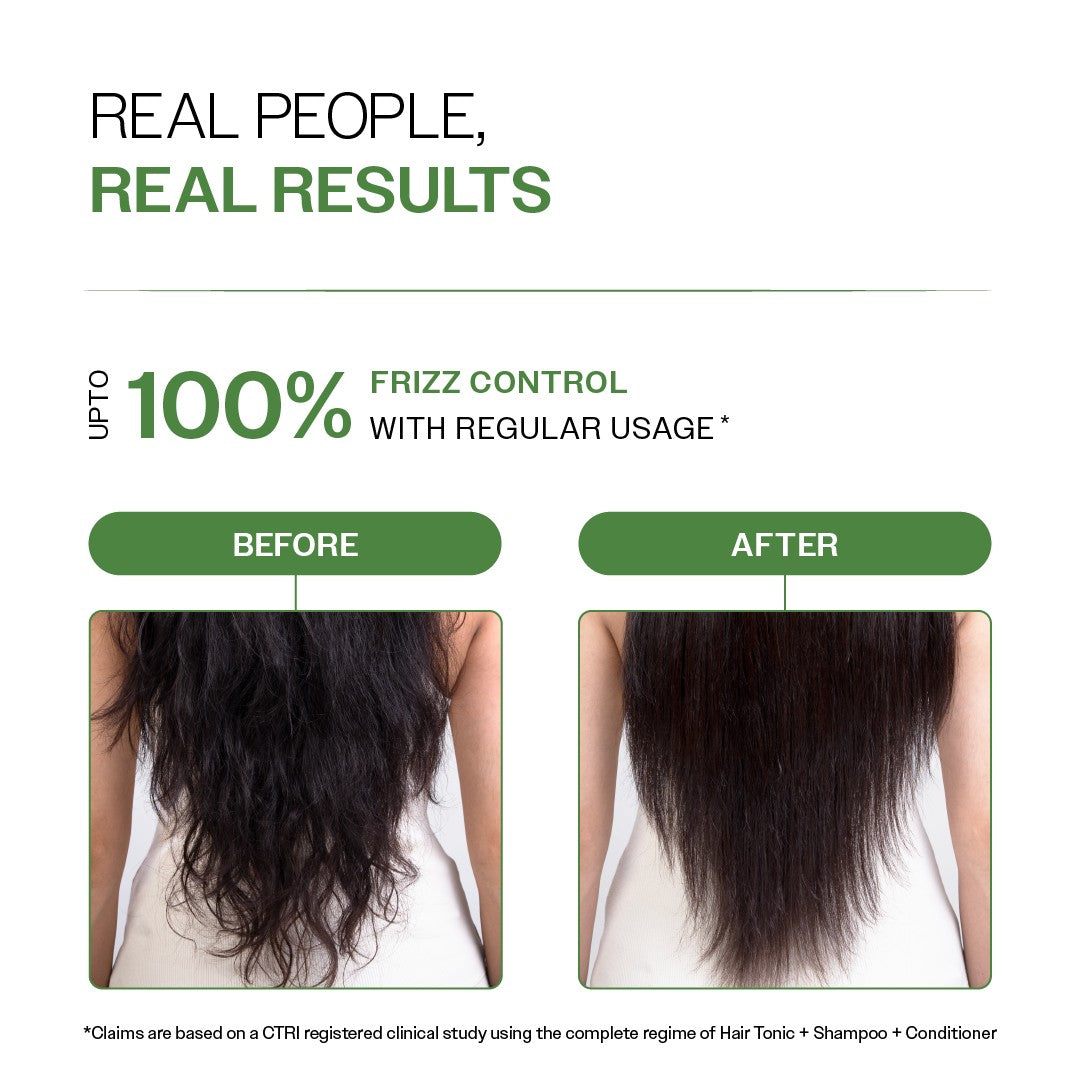 Anti-Dandruff Hair Conditioner with Salicylic Acid, Biotin & Rosemary - 175 gm