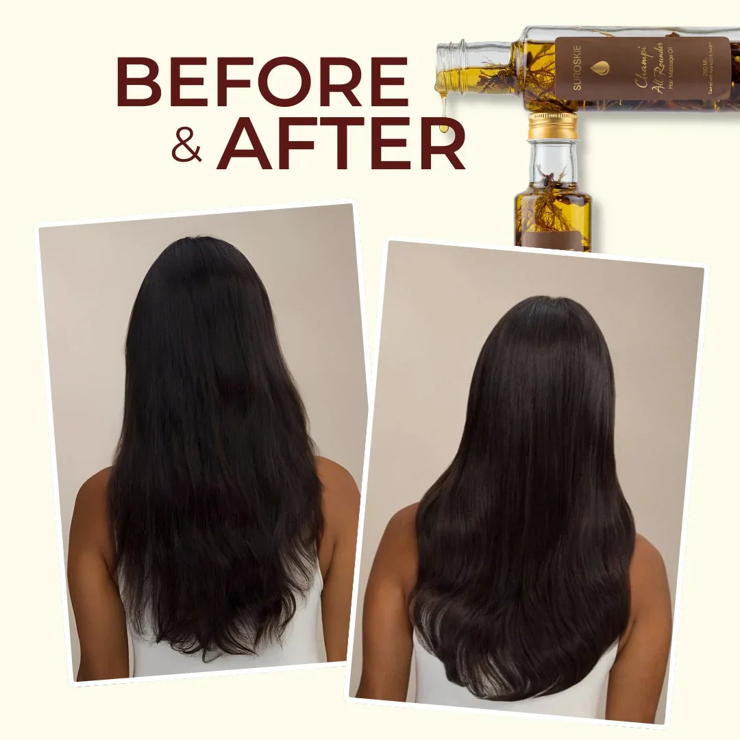 Champi All Rounder Hair Massage Oil