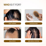 Hair Growth Serum (30 ml) & Anti-Hairfall Shampoo (100 ml) Combo