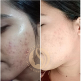 Night Repair Brightening Cream Regular (Effects starts within 10 days)