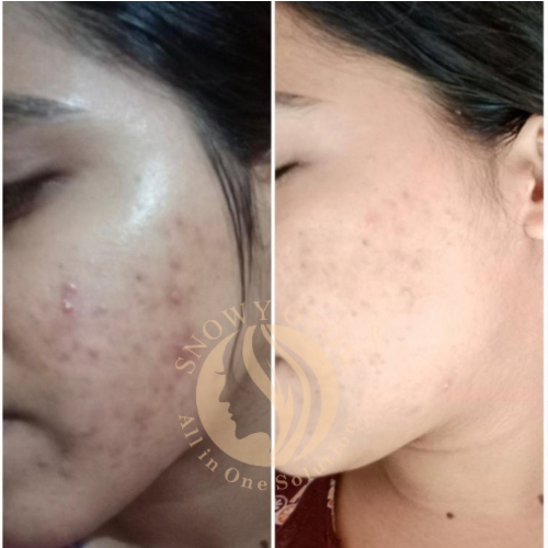 Night repair brightening cream + 24k Gold Facewash