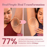 6% AHA BHA Underarm Roll On