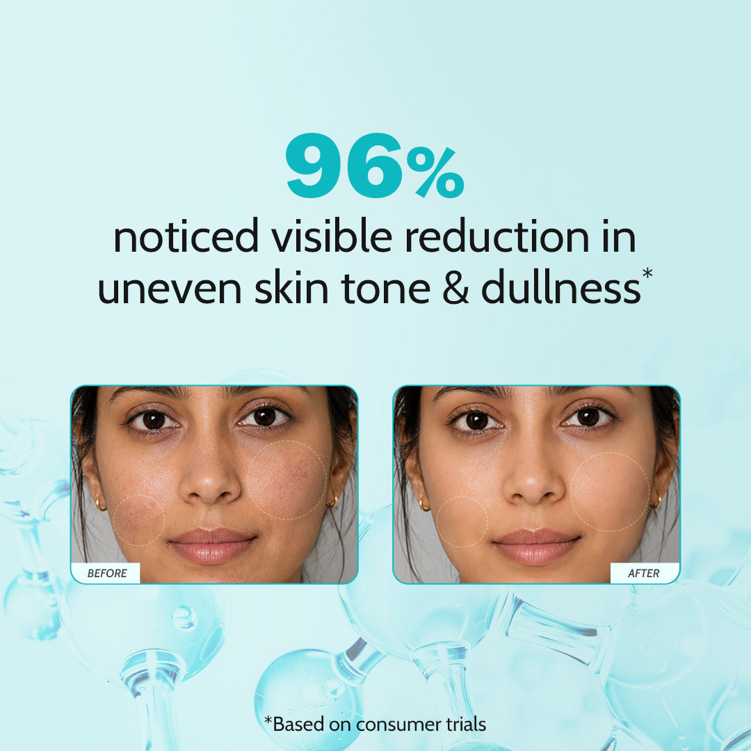 10% Niacinamide Clarifying Face Serum - 10 ml
