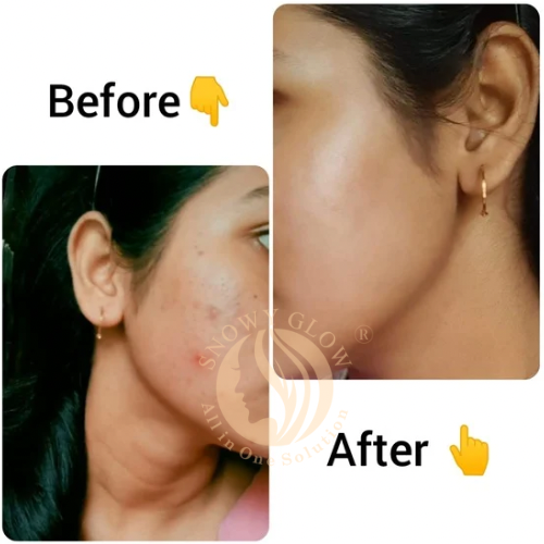 Night Repair Brightening Cream Regular (Effects starts within 10 days)