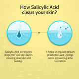 2% Salicylic Acid Face Serum for Acne Control - 30 ml