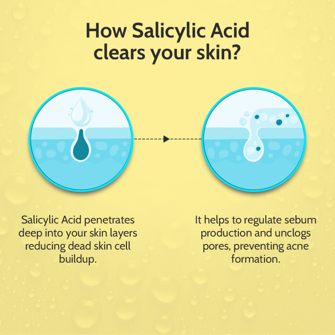 2% Salicylic Acid Face Serum for Acne Control - 10 ml