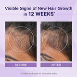 Rosemary & Hibiscus Hair Growth Oil - 100 ml | Pack of 2
