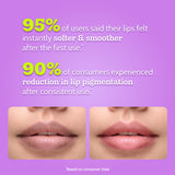 Lip Jelly Kiss Collection - 10 gm | Pack of 4