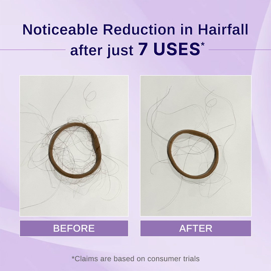 Rosemary & Hibiscus Hair Growth Oil - 100 ml | Pack of 2