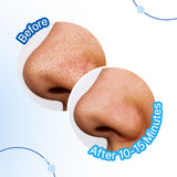 Charcoal Nose Pore Strips | Deep Cleansing