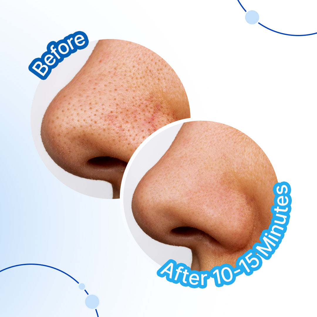 Charcoal Nose Pore Strips | Deep Cleansing
