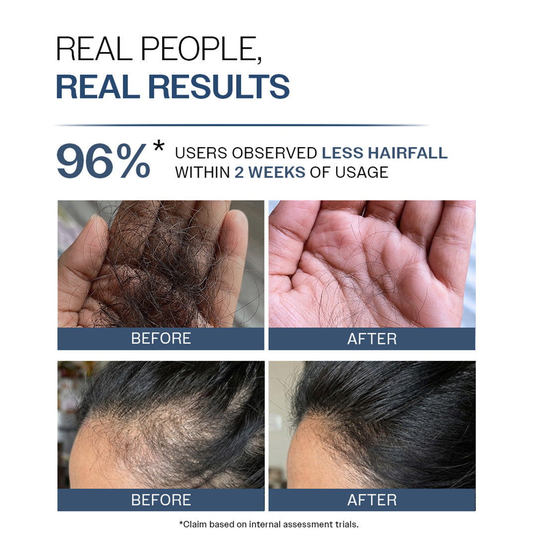 Anti-Hair Fall Shampoo with Adenosine & Peptides - 750 ml