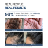 Anti-Hair Fall Shampoo with Adenosine & Peptides - 750 ml