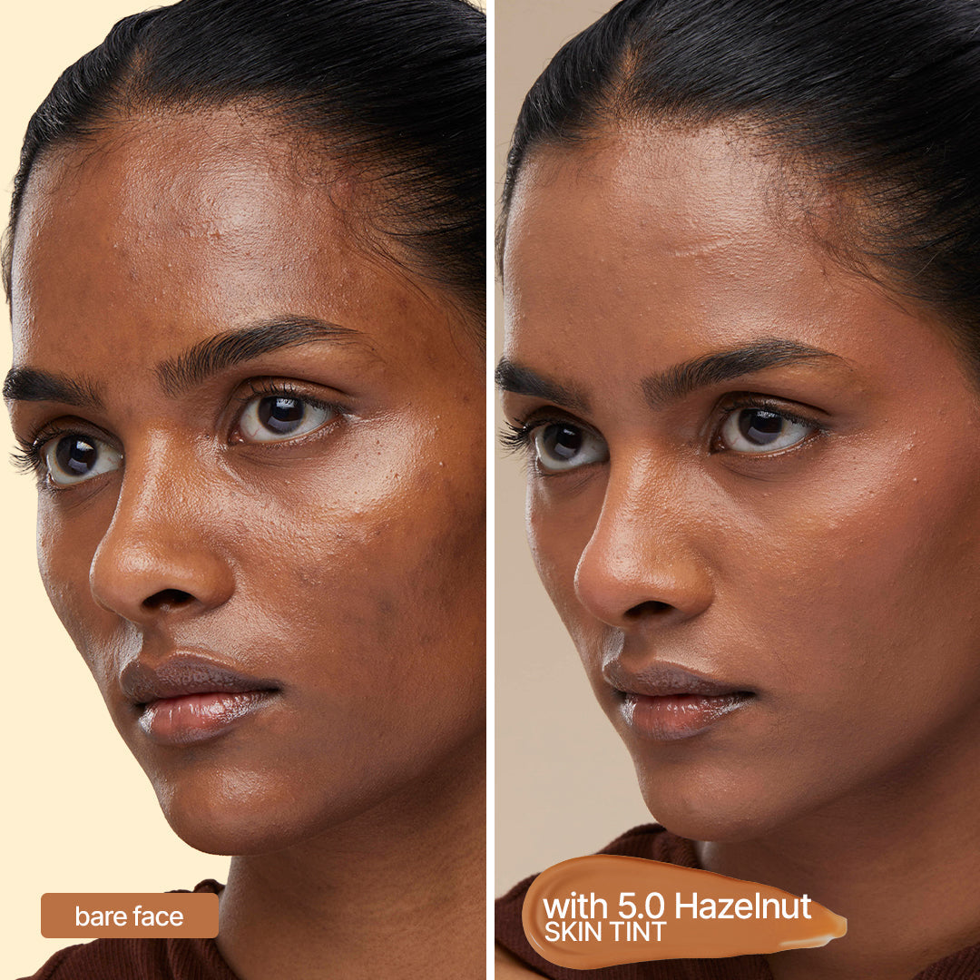 4-in-1 Skin Tint | Light to Medium Coverage