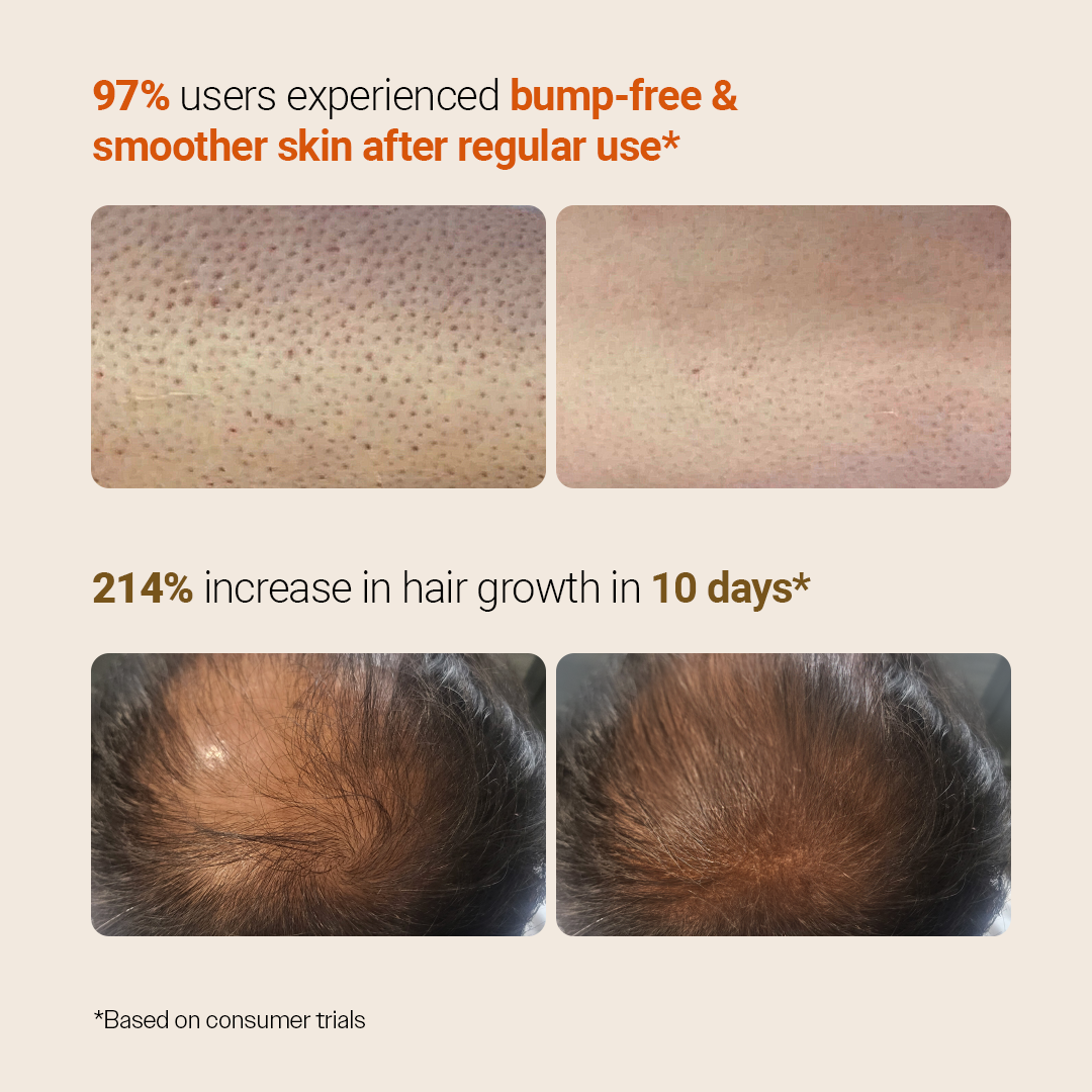 Every Day Body + Haircare Duo (Hair Growth Serum - 30 ml & Exfoliating Body Wash - 236 ml)