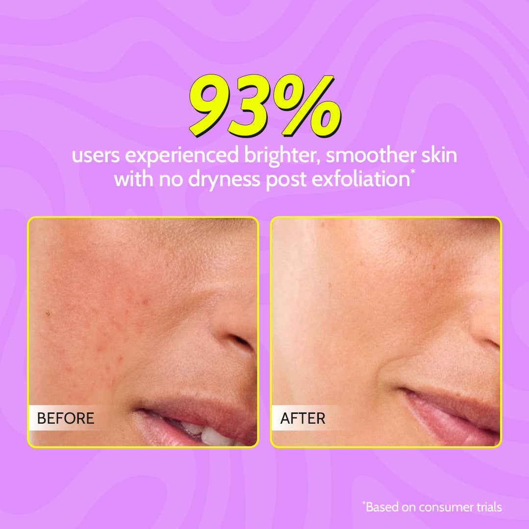 Complete Exfoliation Duo (Gentle Exfoliating Face Scrub - 100 ml | Exfoliating Body Scrub - 75 gm)