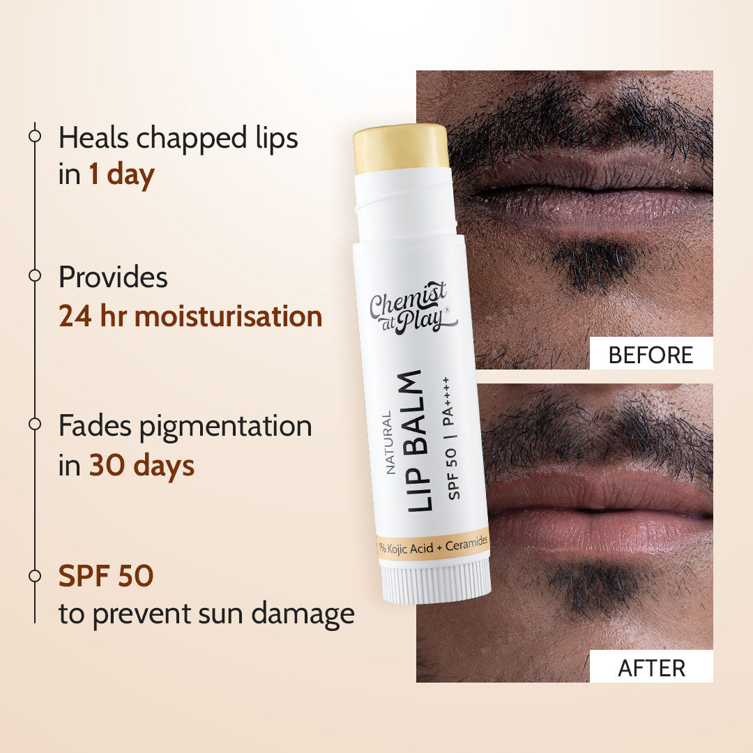 Natural Lip Balm for Chapped & Pigmented Lips | SPF 50 PA++++ & Kojic Acid | 4.5 gm