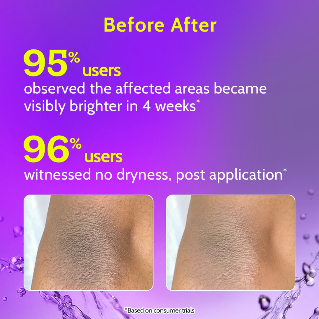 Neck, Knee & Elbow Brightening Roll On - 40 ml