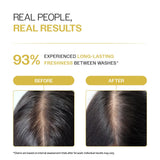 Oil Control Shampoo with Salicylic Acid, Hyaluronic Acid & Tea Tree for Oily Scalp - 236 ml