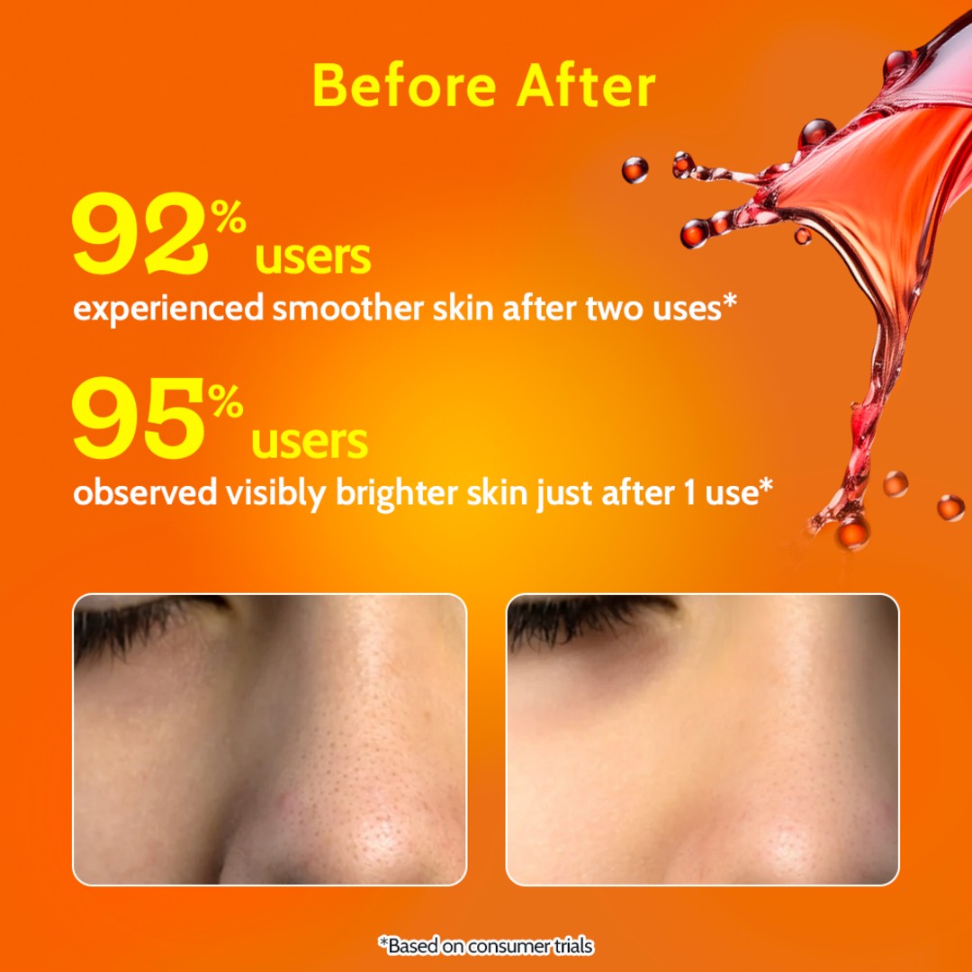 Exfoliating Peeling Solution - 30 ml | Pack of 2