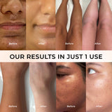 Niconi Tan Vanish Gluta-Kojic Skin Polish - Salon