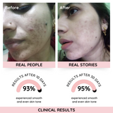 Rose Instant Glow Enzyme Scrub