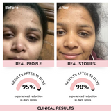Rose Glass All-Rounder Skin Serum