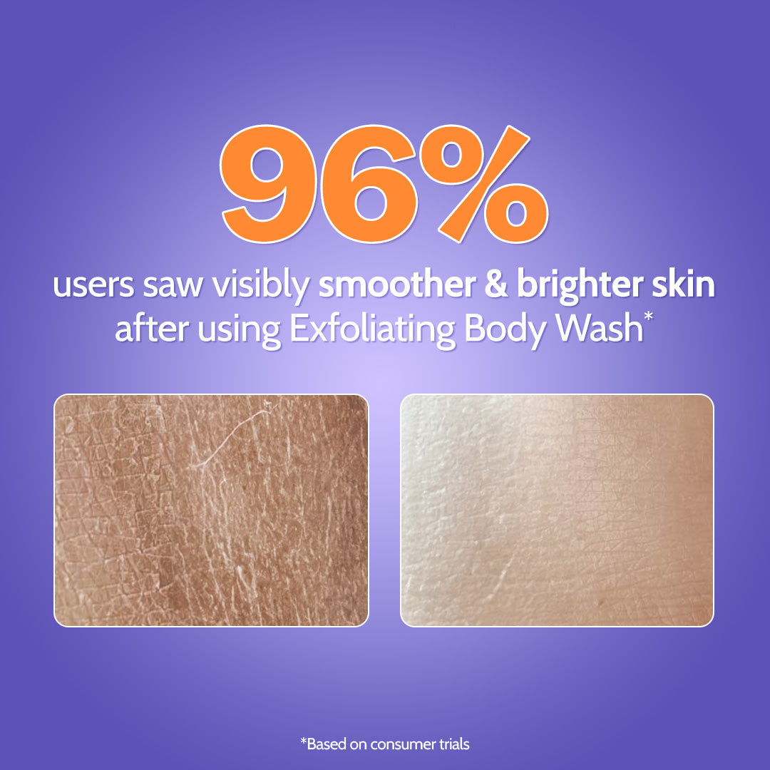 The Skin Reset Duo (Intensely Hydrating Gel Moisturizer - 100 gm | Exfoliating Body Wash - 236 ml)