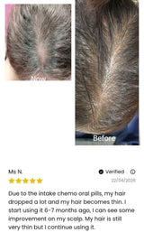 Advance Hair Growth Serum 2.0 (30ml)