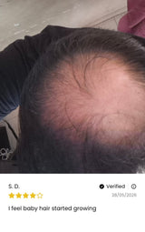 Advance Hair Growth Serum 2.0 (30ml)