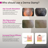 Derma Stamp with Sanitizer | Adjustable Titanium-Coated Needles