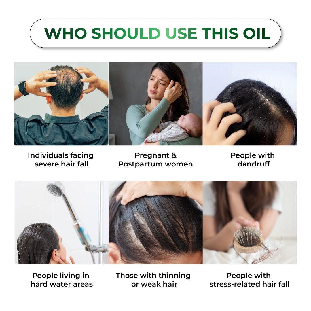Niconi Herbal Hair Oil 200ml (B2B)