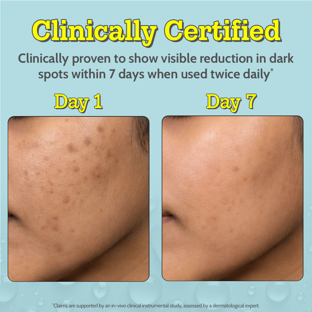 10% Vitamin C Serum for Glowing & Bright Skin - 10 ml | Pack of 3