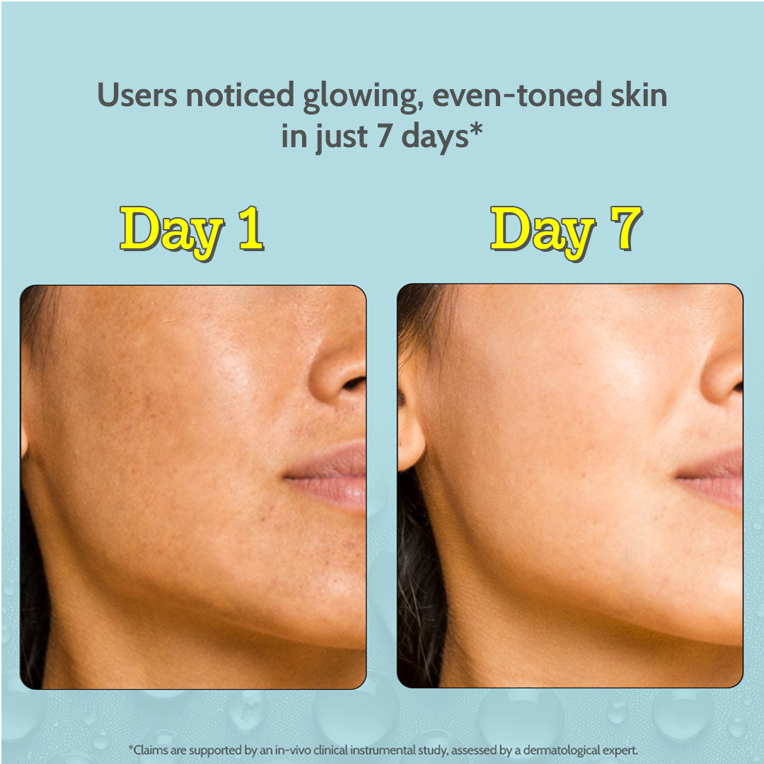 10% Vitamin C Serum for Glowing & Bright Skin - 30 ml | Pack of 3