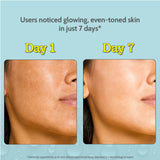 10% Vitamin C Serum for Glowing & Bright Skin - 10 ml | Pack of 3