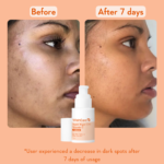 SUPERBRIGHTC16VITAMINCSERUM