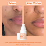 SUPERBRIGHTC16VITAMINCSERUM
