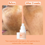 SUPERBRIGHTC16VITAMINCSERUM