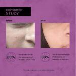 Retinol_serum